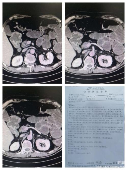 c894304d907a5de83b6b15806e6691f3