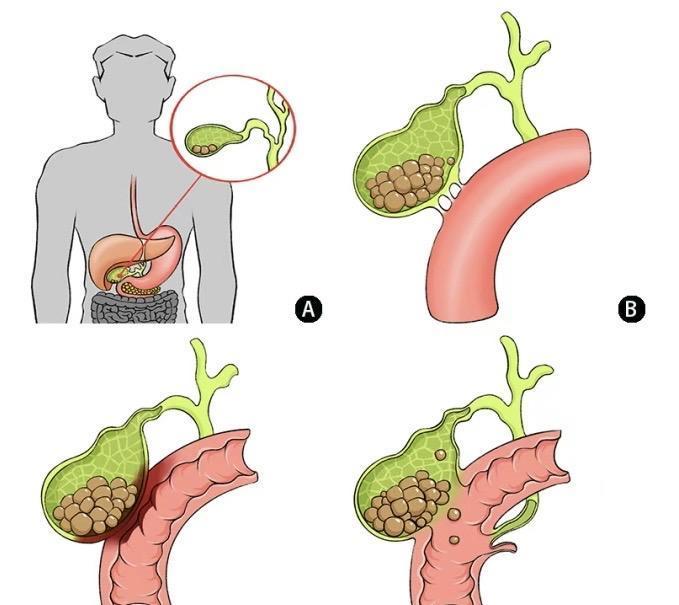 5ec16643a23c4c7eb8e702f28a17abc5