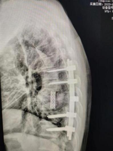 b5aa68a144c5577ea20edc464c2e6d2