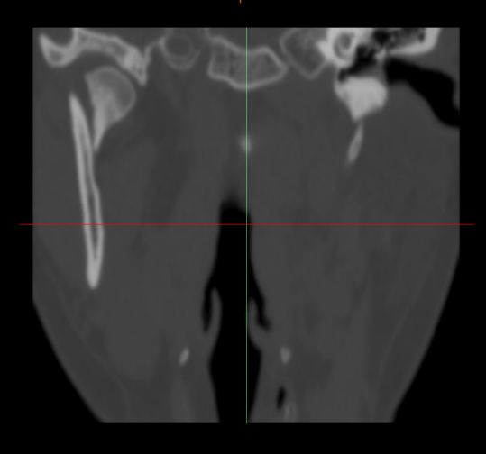 15e54215aebcdd33cd9a6a894ed33a0