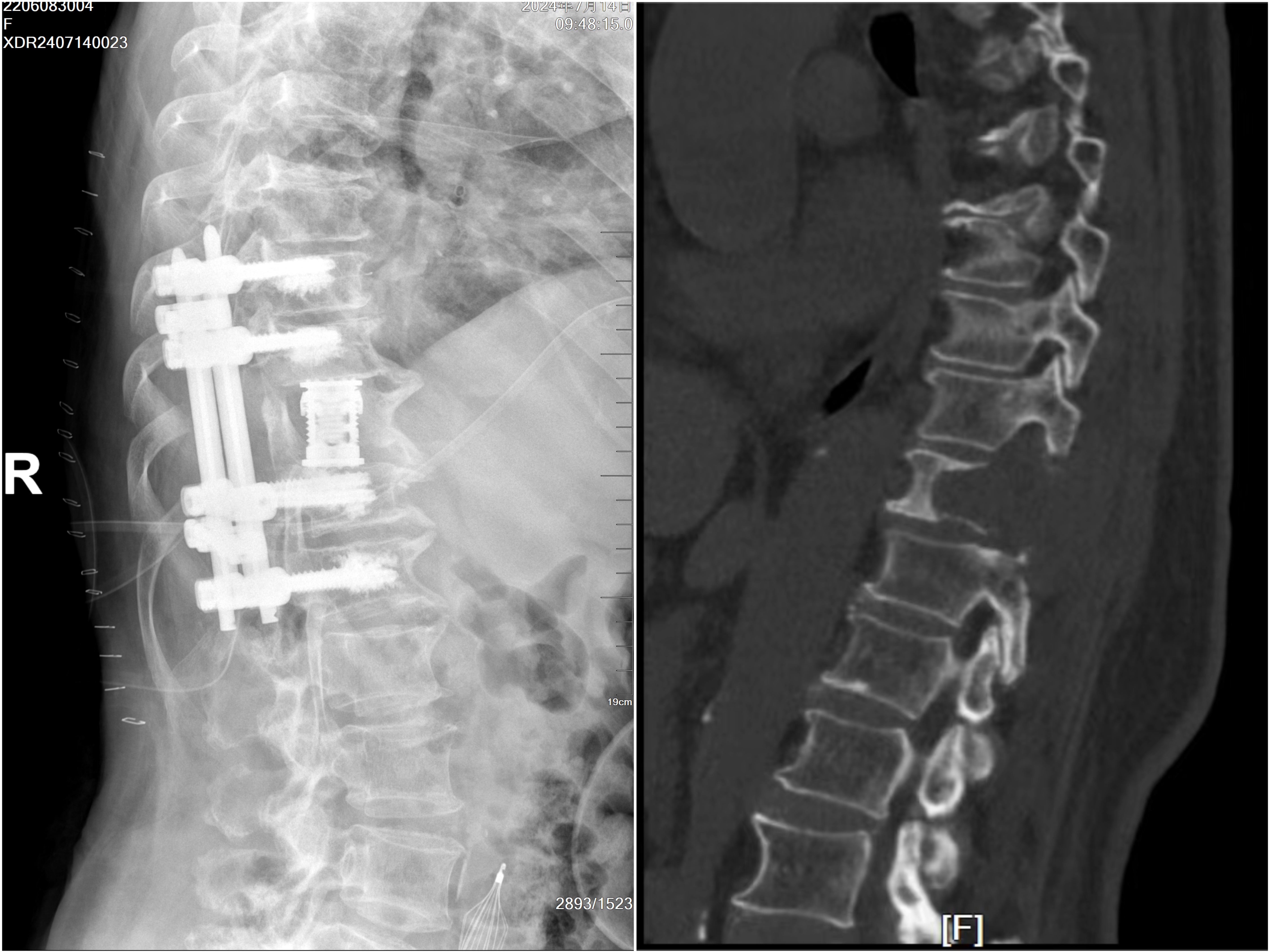 23f6e39d203612b6fcdf2ff93998cf3