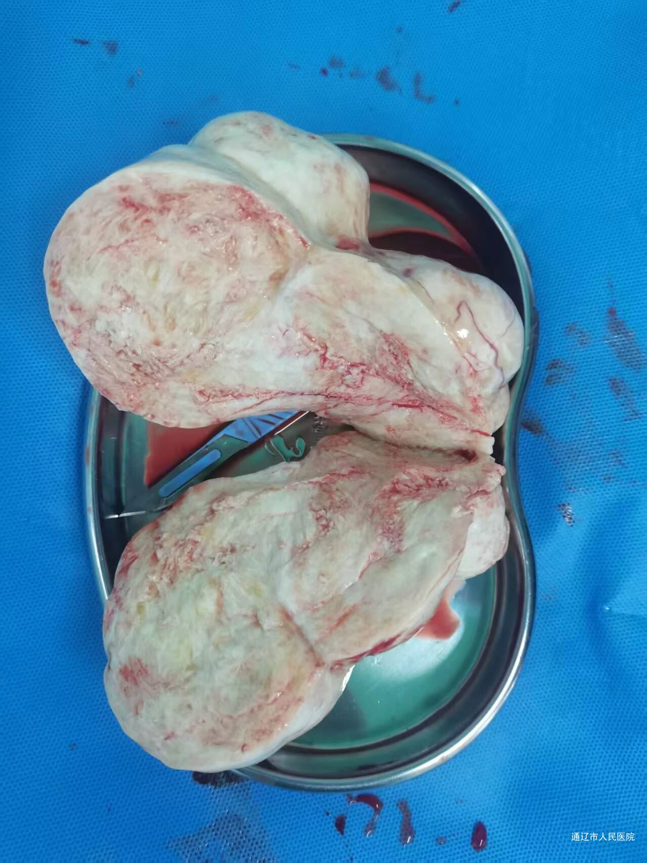 微信图片_2025-09-12_095711_517.jpg 微信图片_2025-09-12_095711_517.jpg