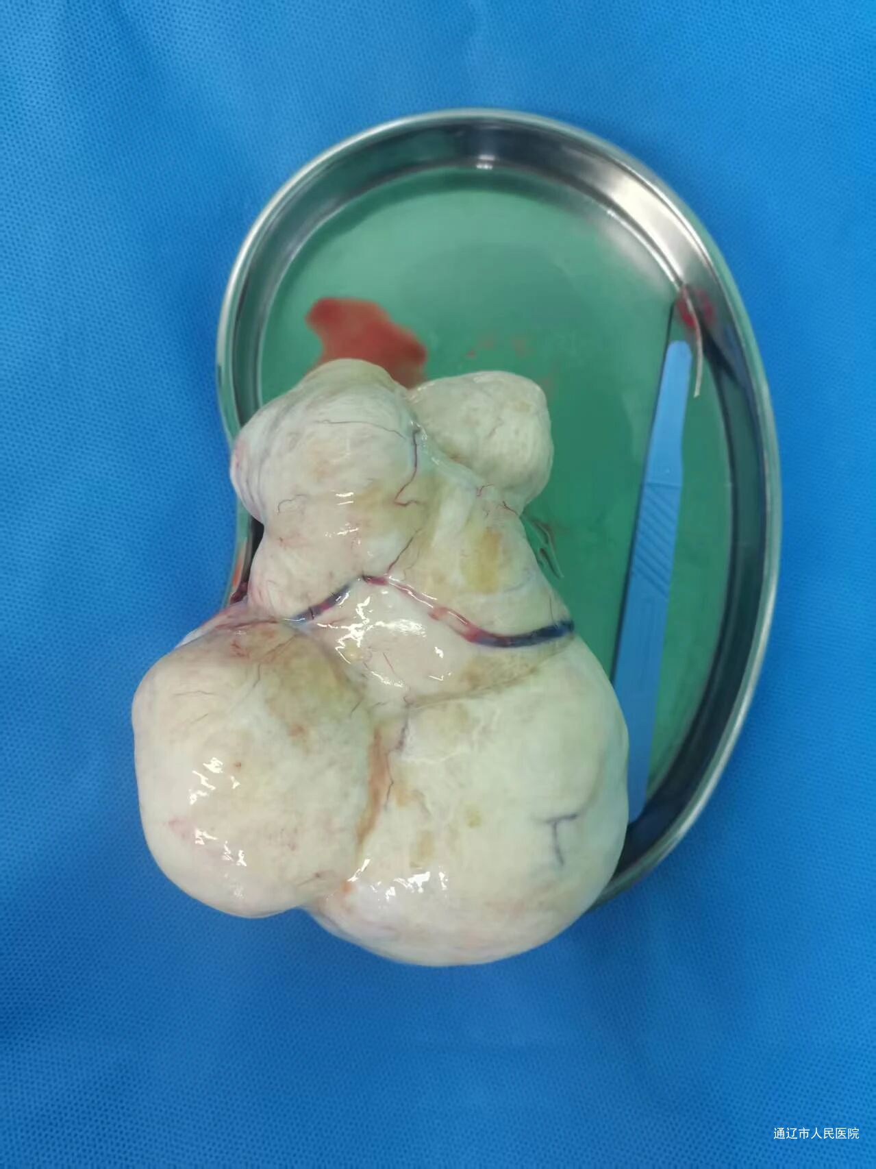 微信图片_2025-09-12_095715_622.jpg 微信图片_2025-09-12_095715_622.jpg