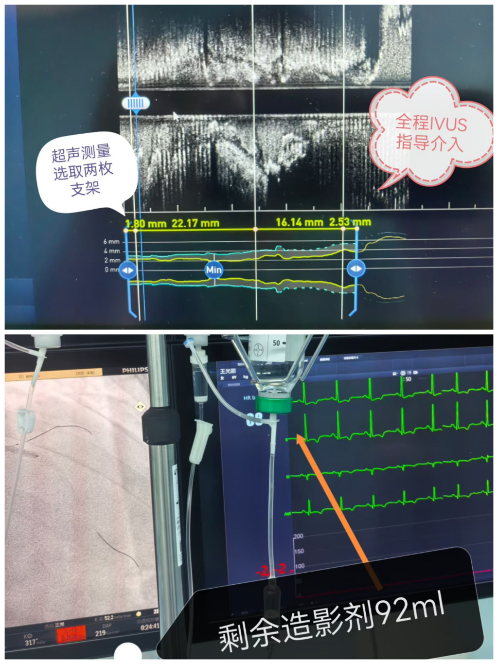 微信图片_2026-03-09_083933_638.png 微信图片_2026-03-09_083933_638.png