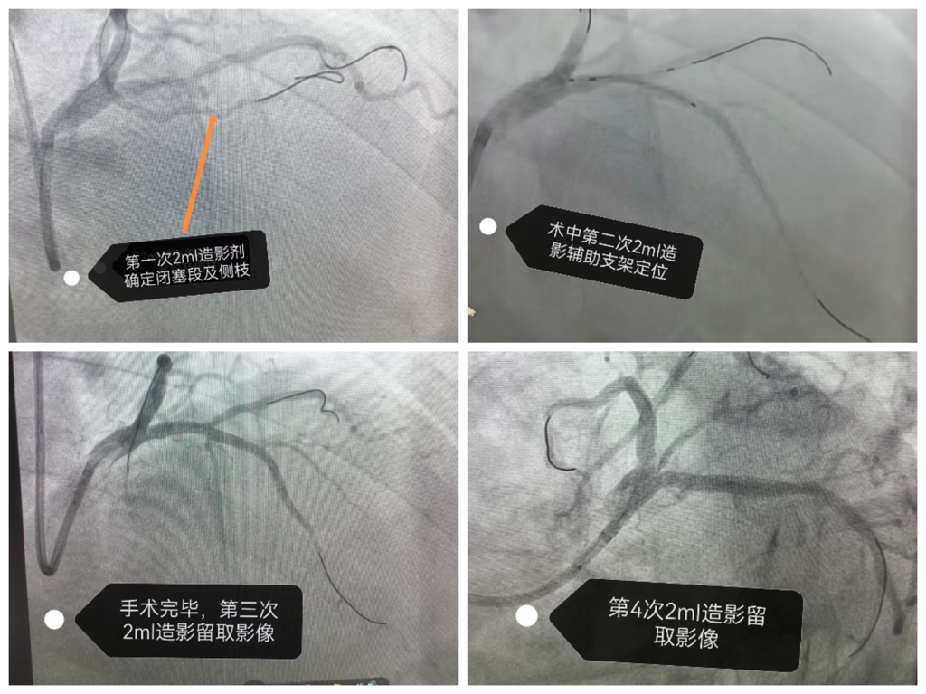 微信图片_2026-03-09_083929_222.png 微信图片_2026-03-09_083929_222.png